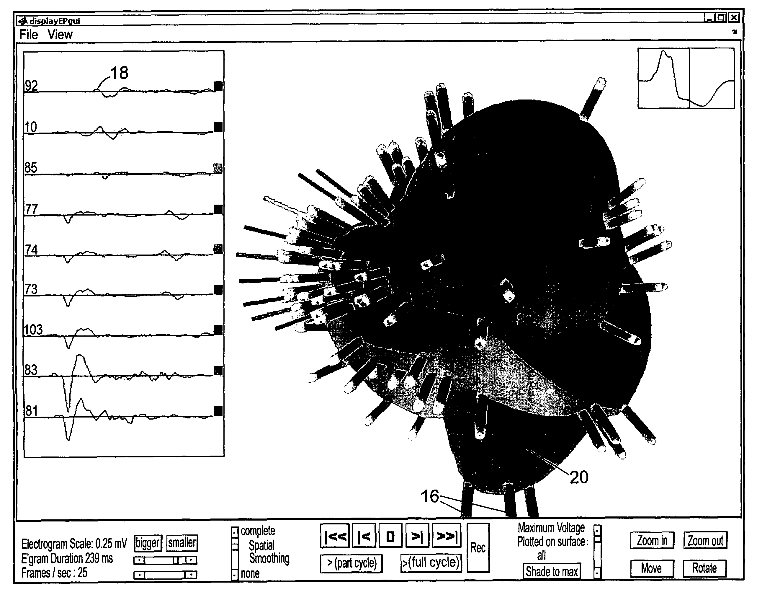 Method of and apparatus for generating a model of a cardiac surface having a plurality of images representing electrogram voltages