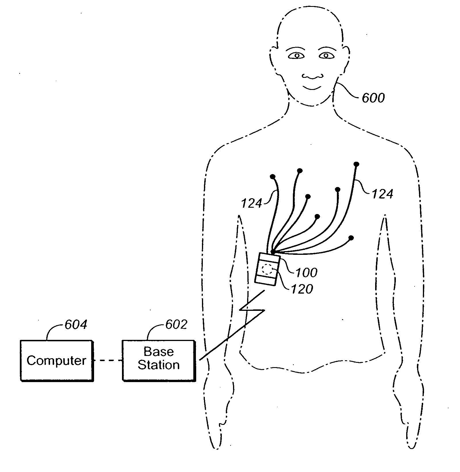 Portable cardiac monitor including RF communication