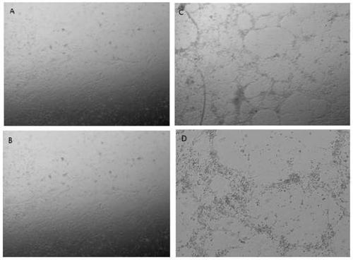 A method for promoting the differentiation of human induced pluripotent stem cells into neurons