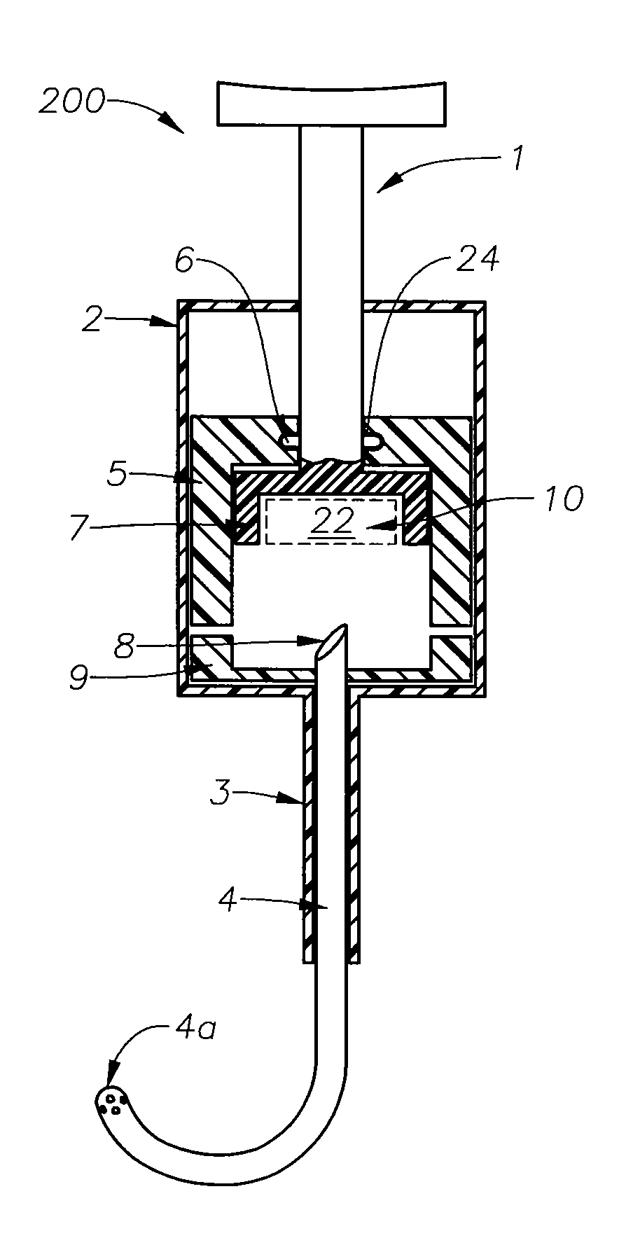 Juxtascleral drug delivery and ocular implant system