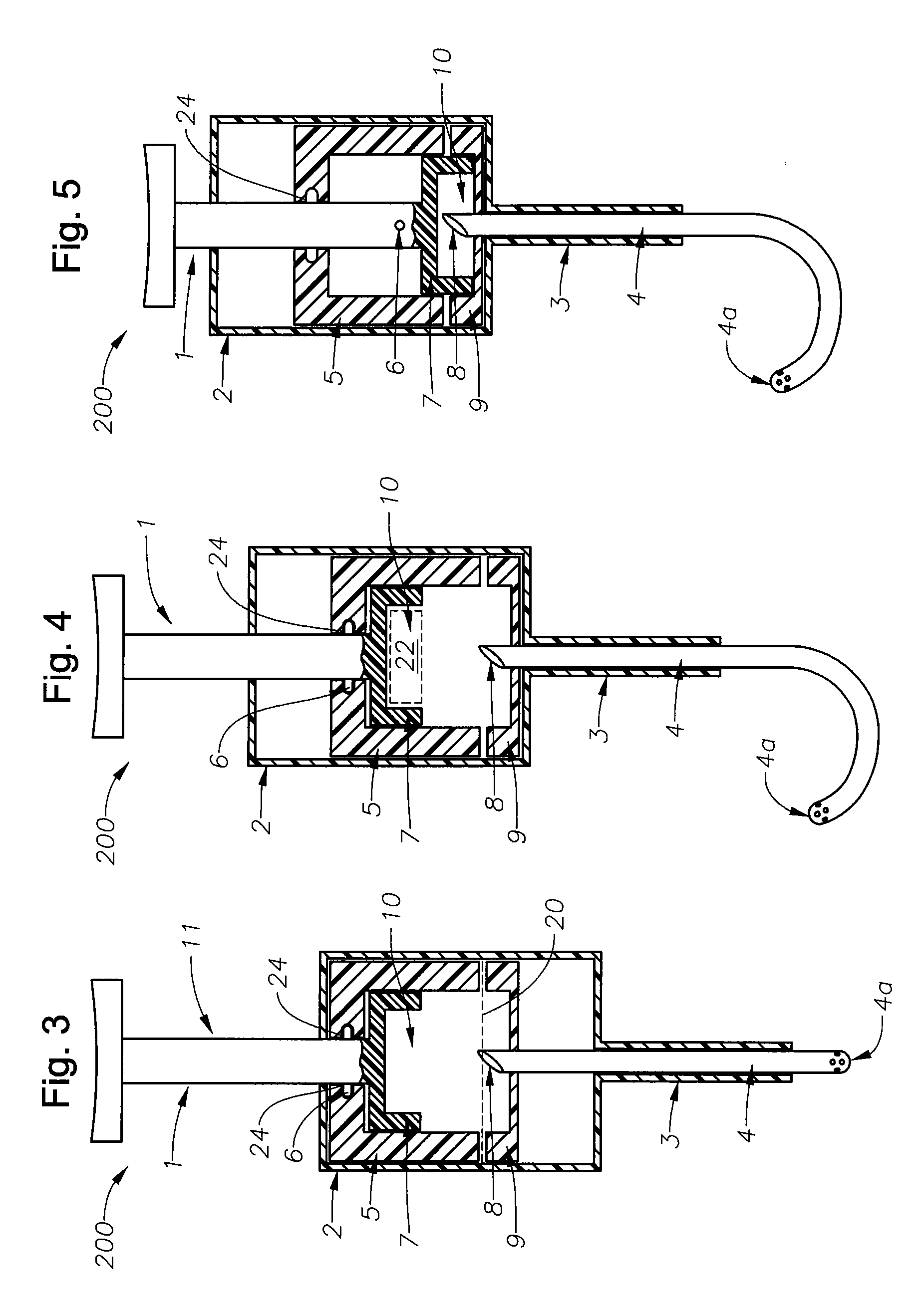 Juxtascleral drug delivery and ocular implant system