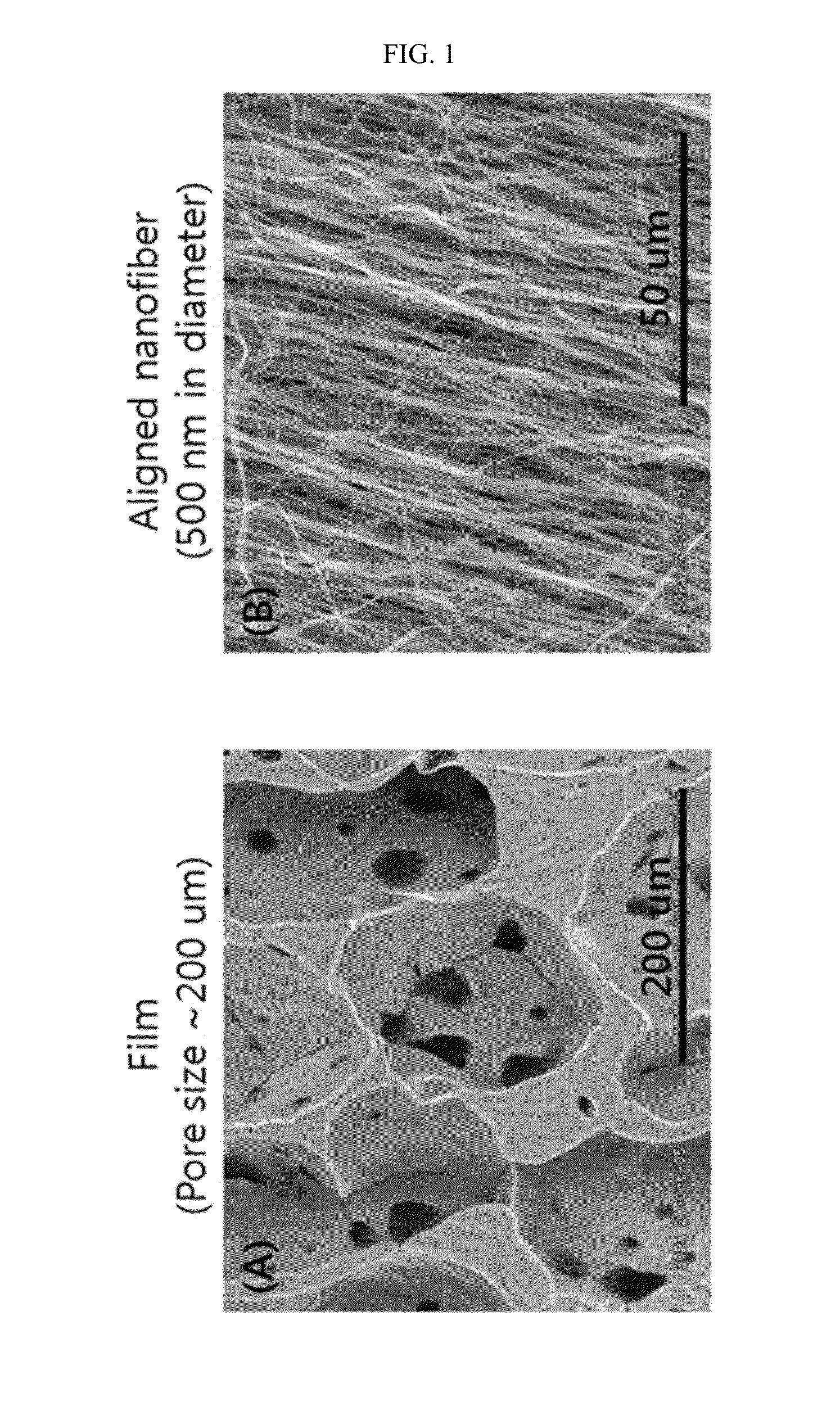 Scaffold for articular cartilage regeneration and method for manufacturing same