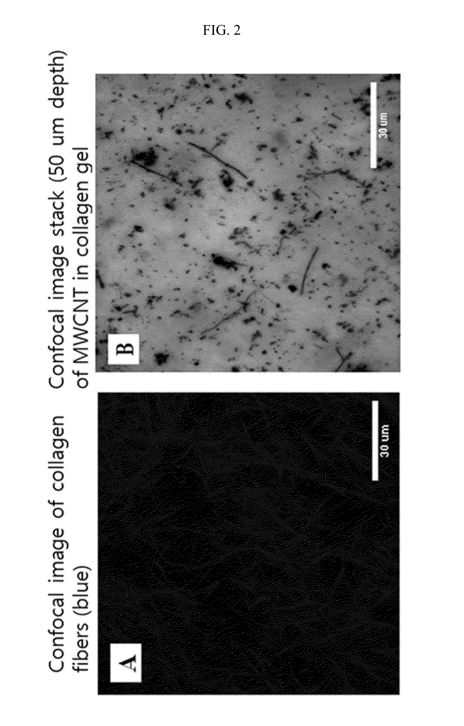 Scaffold for articular cartilage regeneration and method for manufacturing same