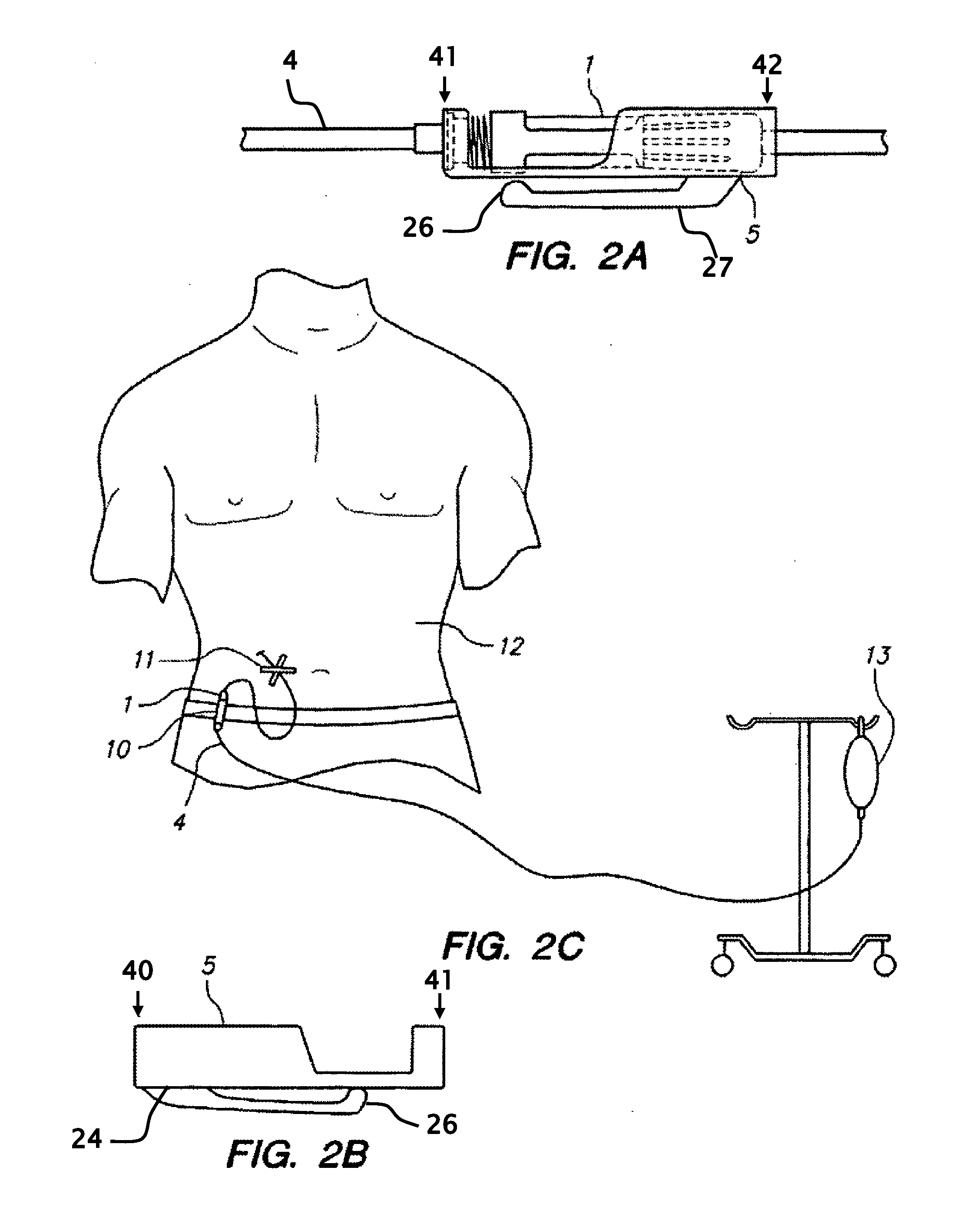 User wearable device for carrying peritoneal dialysis catheter