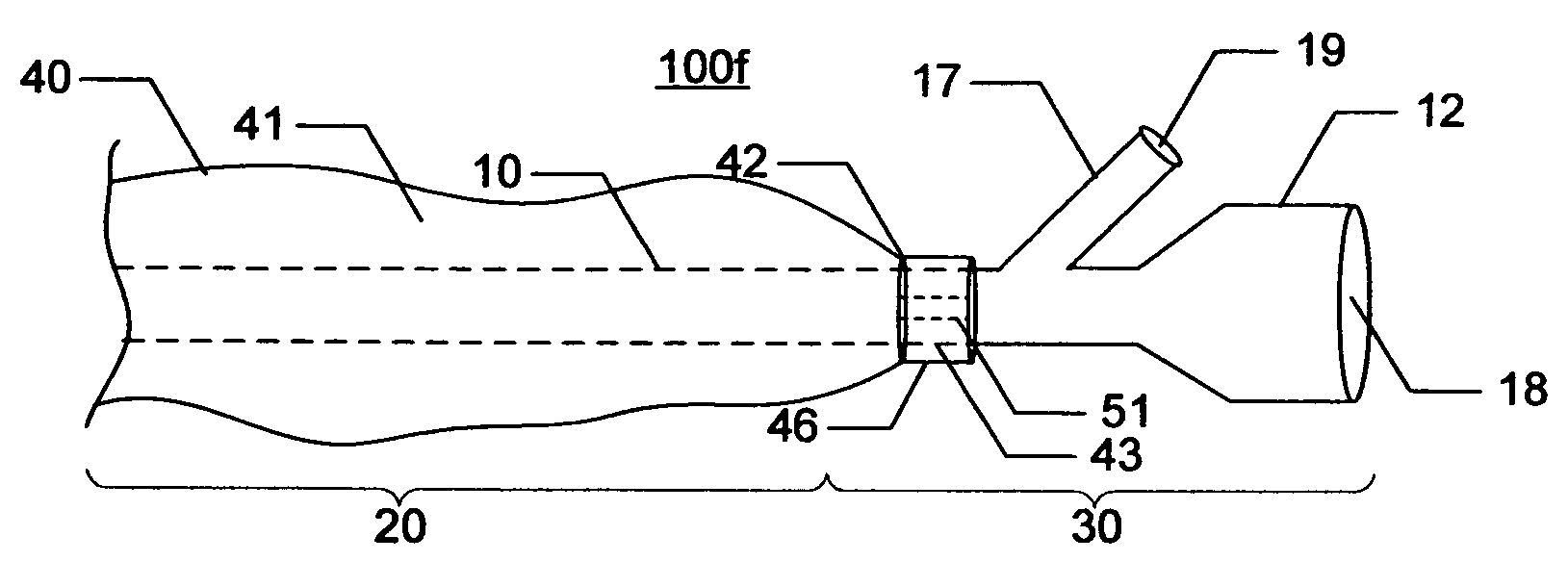 Indwelling urinary catheterization assembly