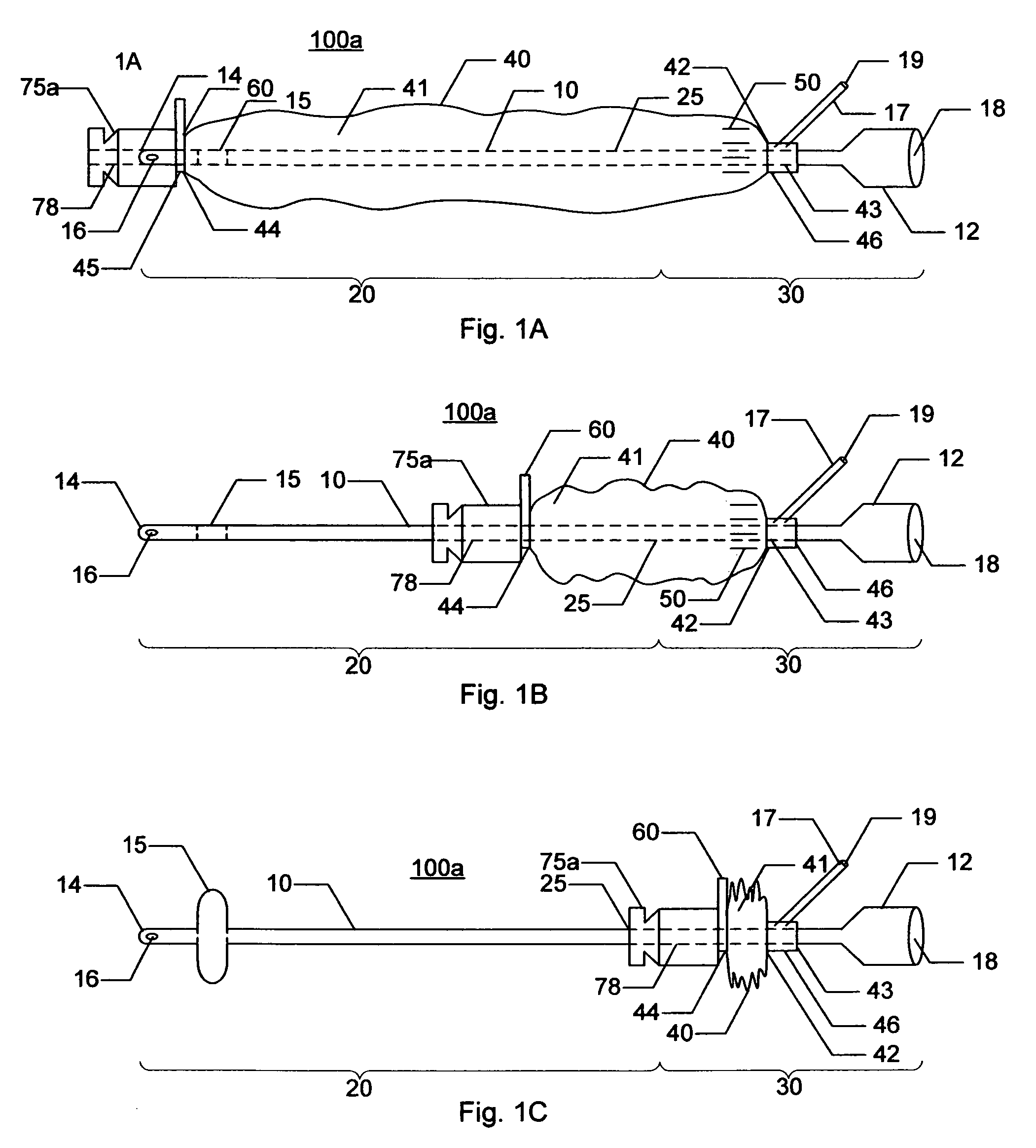 Indwelling urinary catheterization assembly