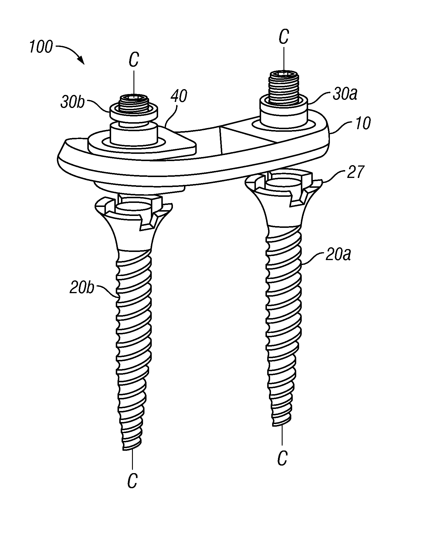 Posterior Lumbar Plate