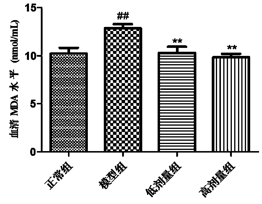 Applications of black rice anthocyanin extract in preparing medicament for protecting restraint stress-induced liver injury