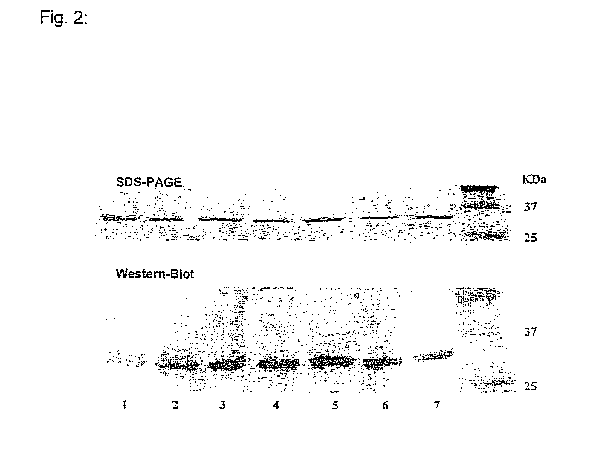 Fusion polypeptides, and use thereof in antivascular tumor therapy