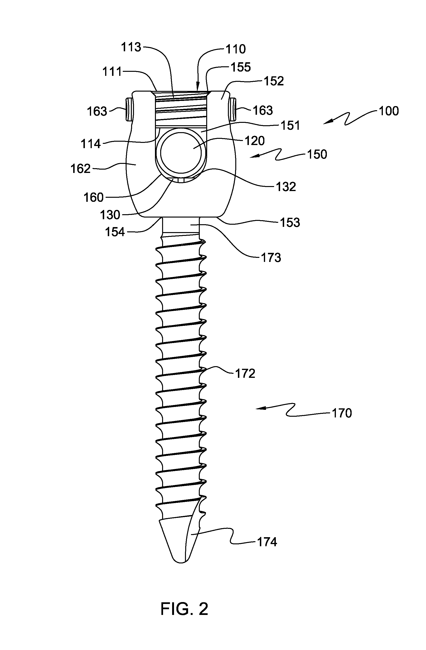 Pedicle screw assembly and method of assembly