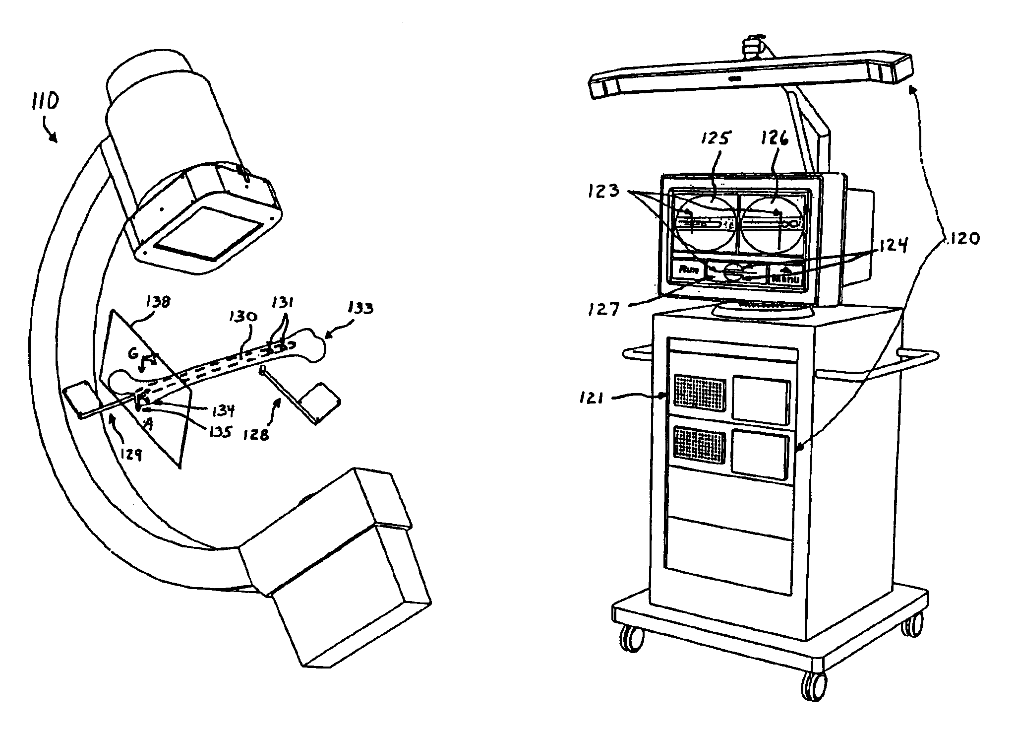 Computer assisted intramedullary rod surgery system with enhanced features