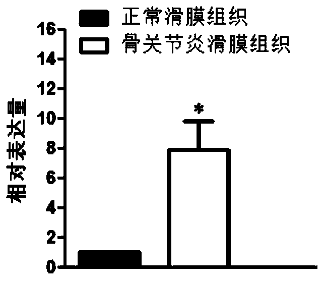 Application of AGAP9 in preparation of osteoarthritis diagnosis product