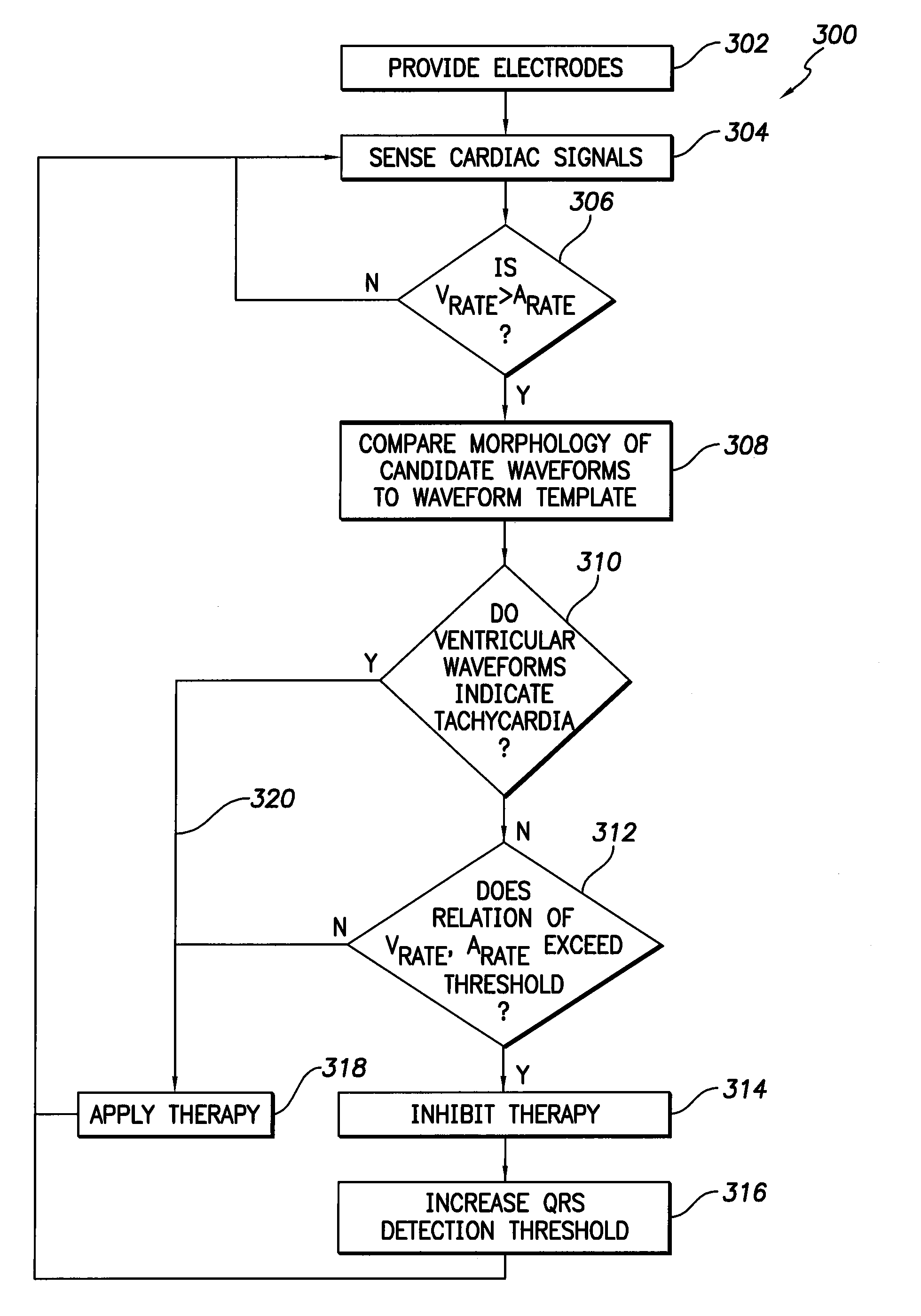 Methods and systems for discriminating between ventricular waveforms when ventricular rate exceeds atrial rate