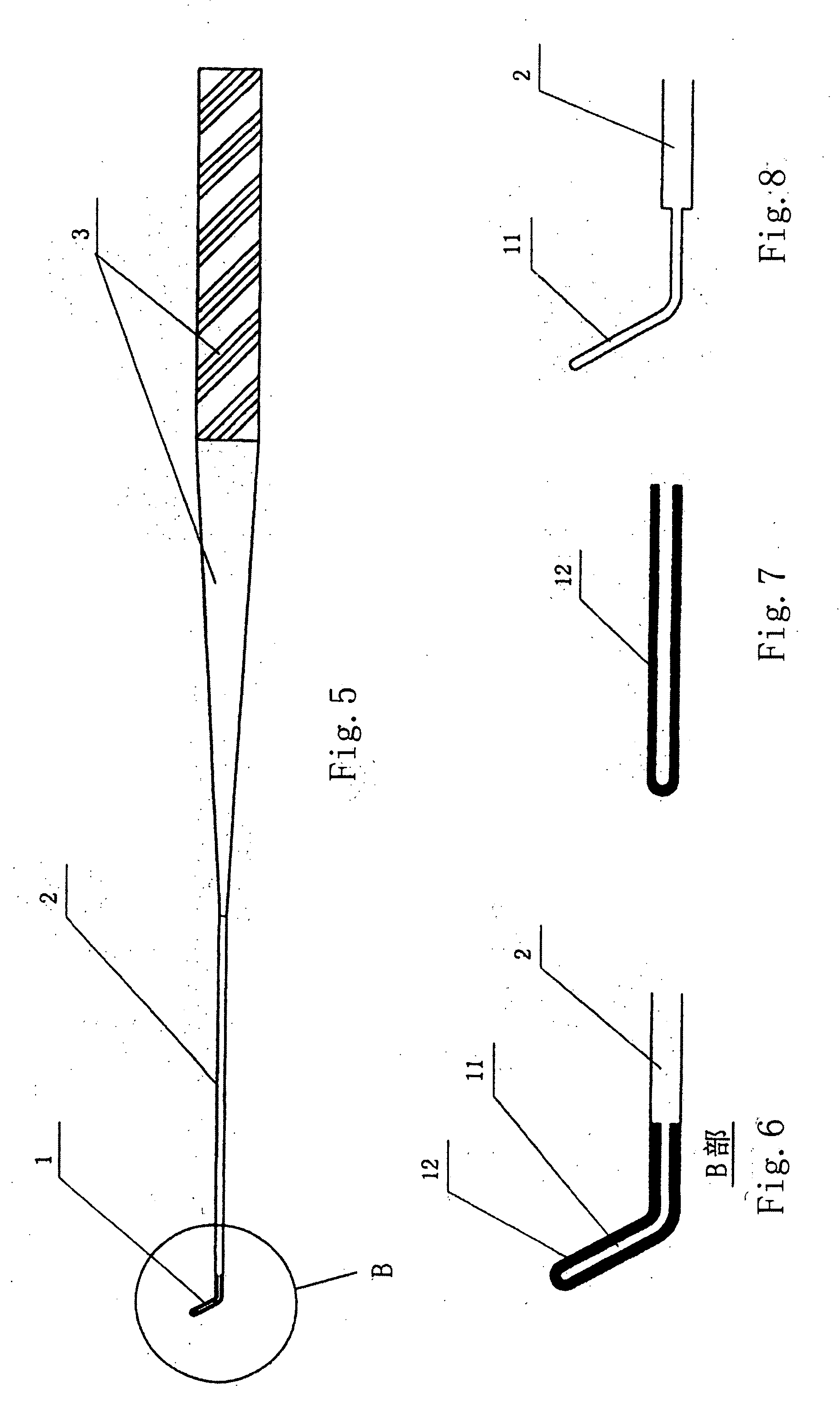 Retinal flattener