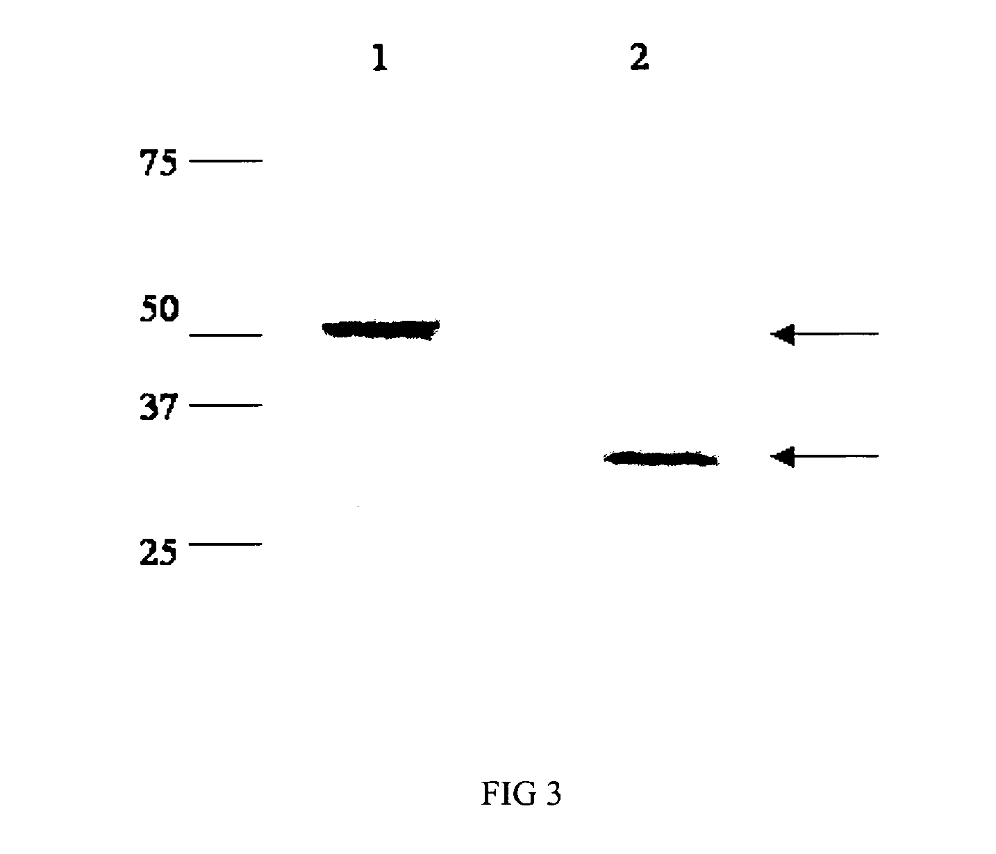 Recombinant antigens for the detection of Coxiella burnetii