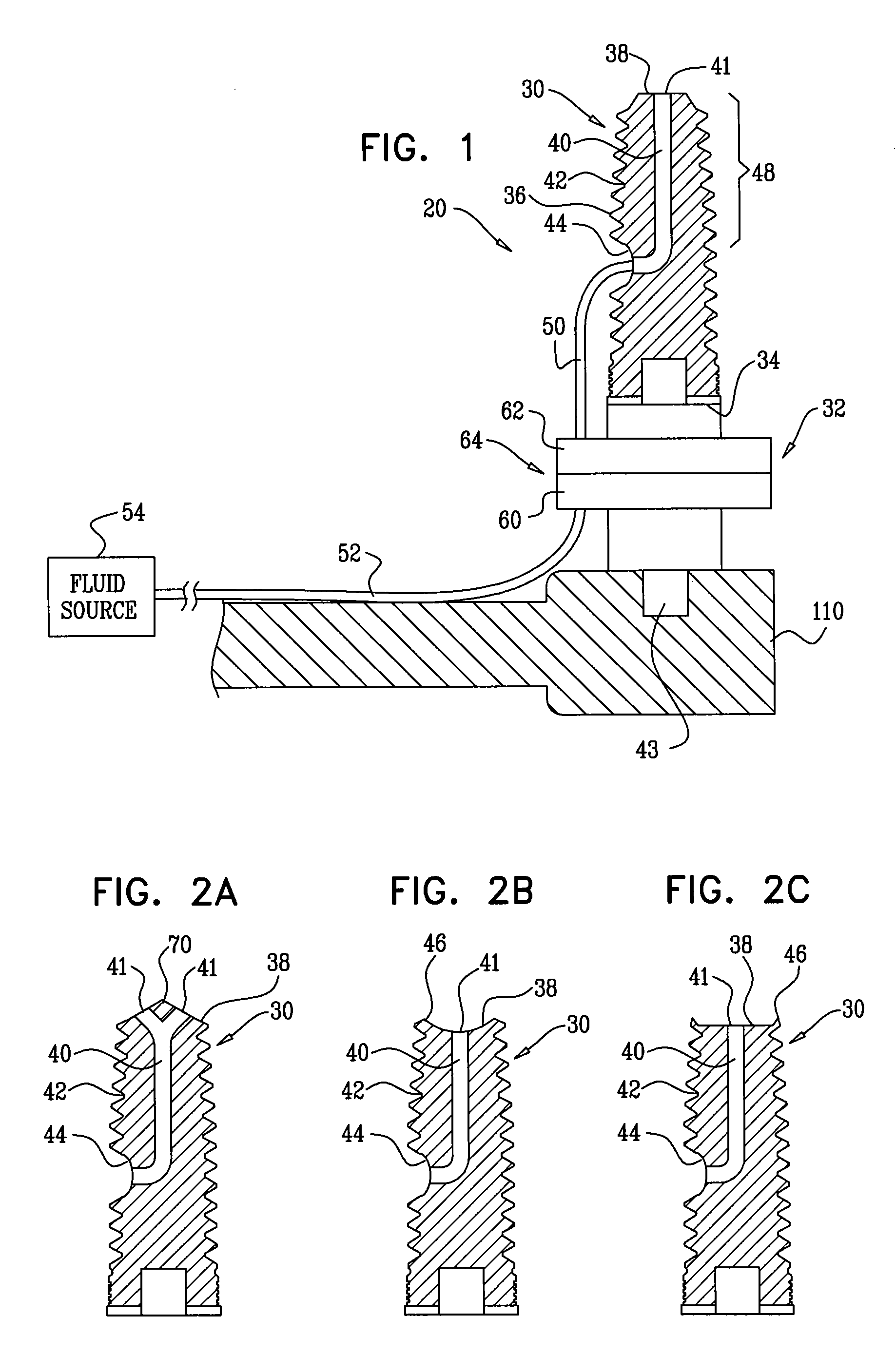 Implants, tools, and methods for sinus lift and lateral ridge augmentation