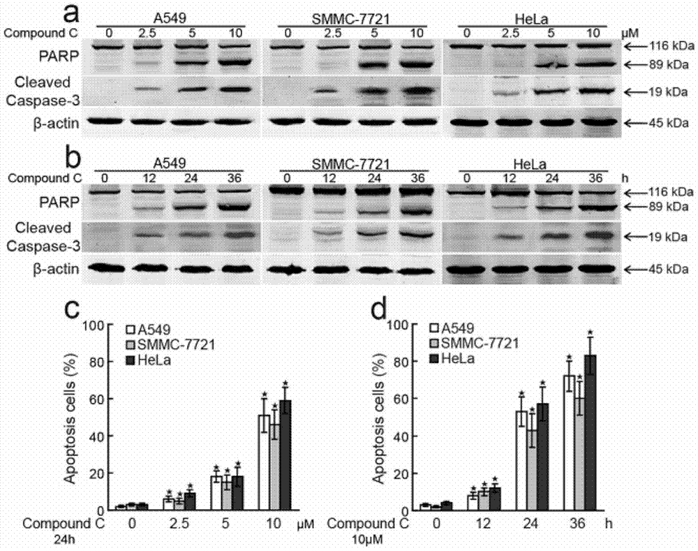 Application of pyrazolopyrimidine compound in preparation of transcription inhibitor medicine