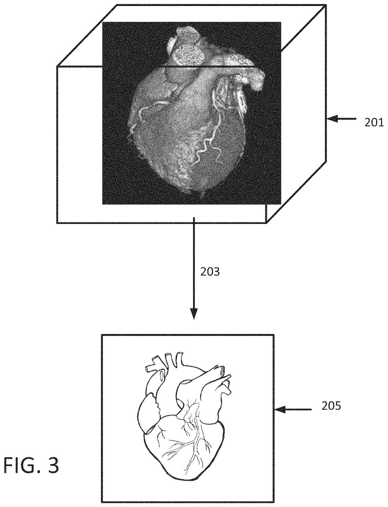 Method for memorable image generation for anonymized three-dimensional medical image workflows