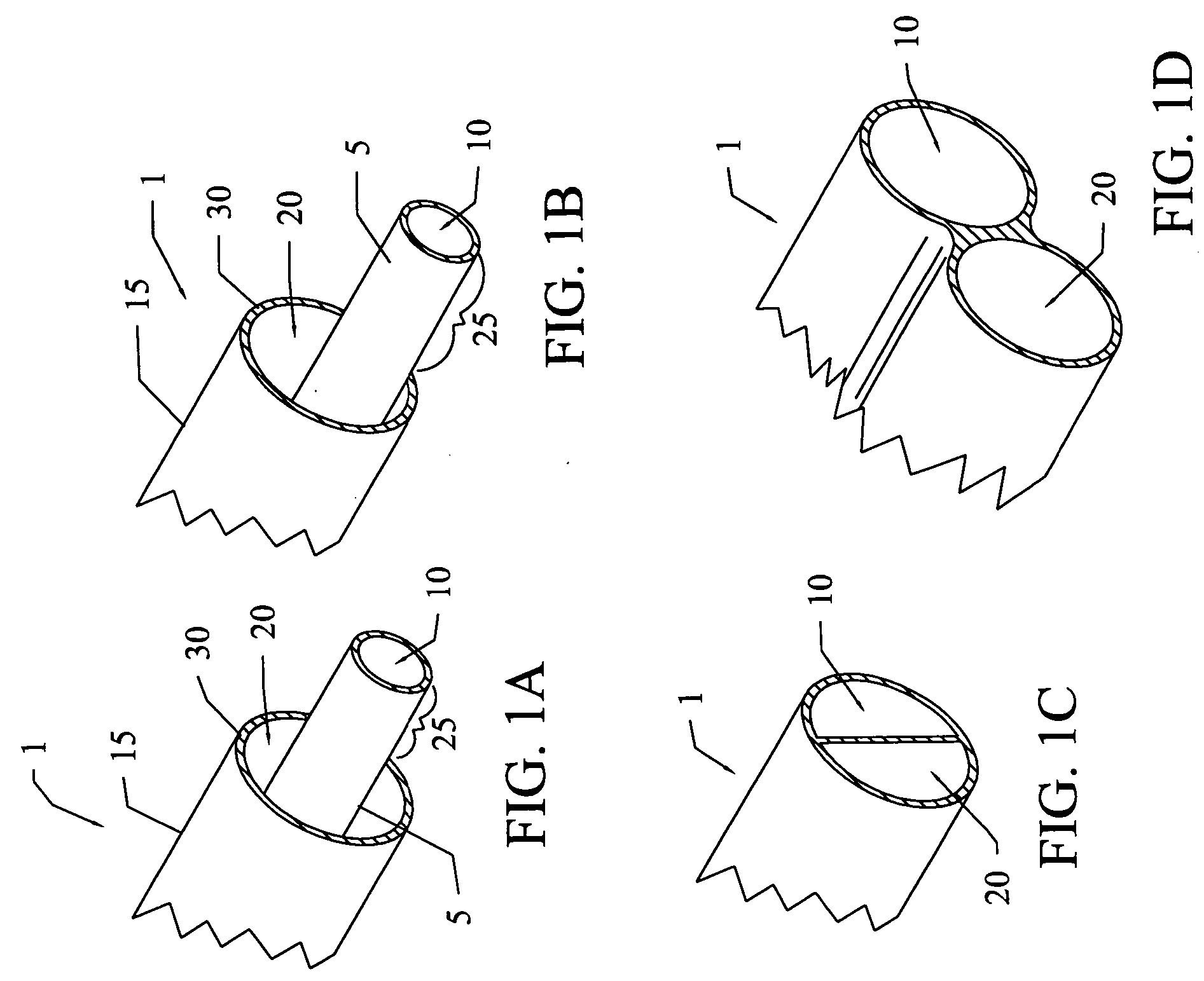 Dialysis catheter system