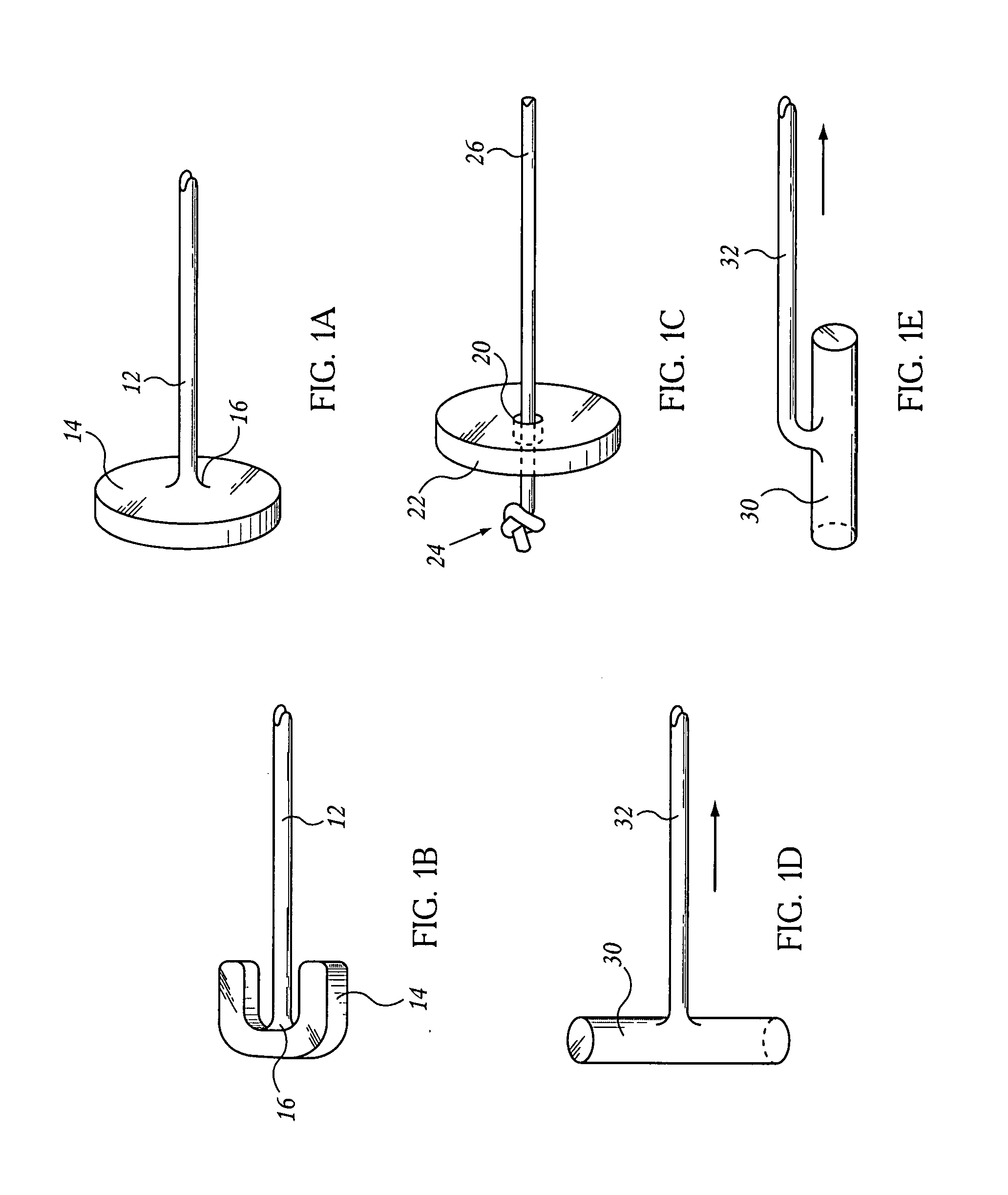 Extragastric Balloon With Attachment Tabs