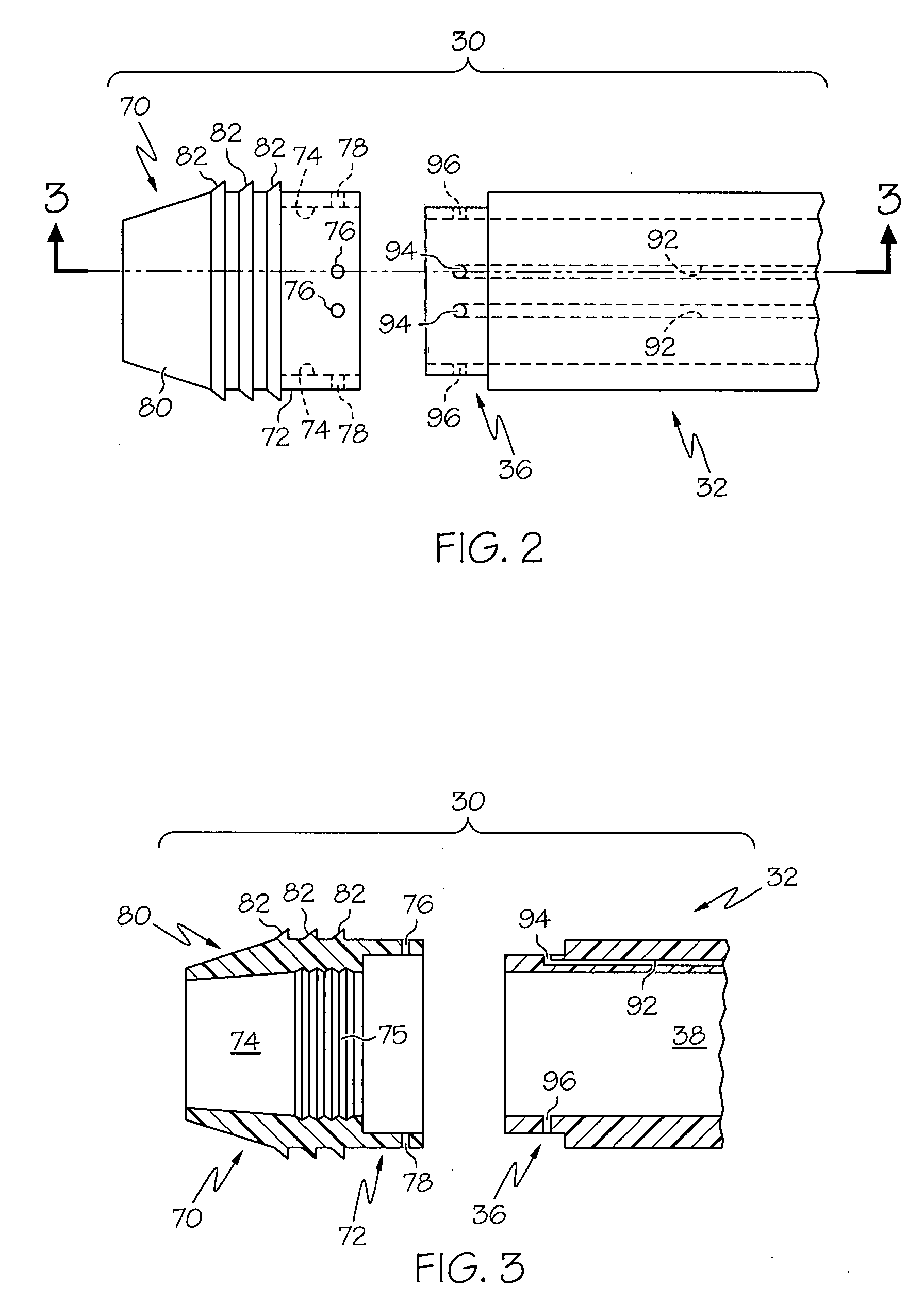 Detachable distal overtube section and methods for forming a sealable opening in the wall of an organ