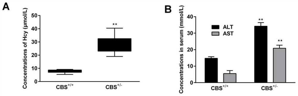 Screening method and application of ERO1alpha molecular marker related to liver injury endoplasmic reticulum stress unfolded protein response