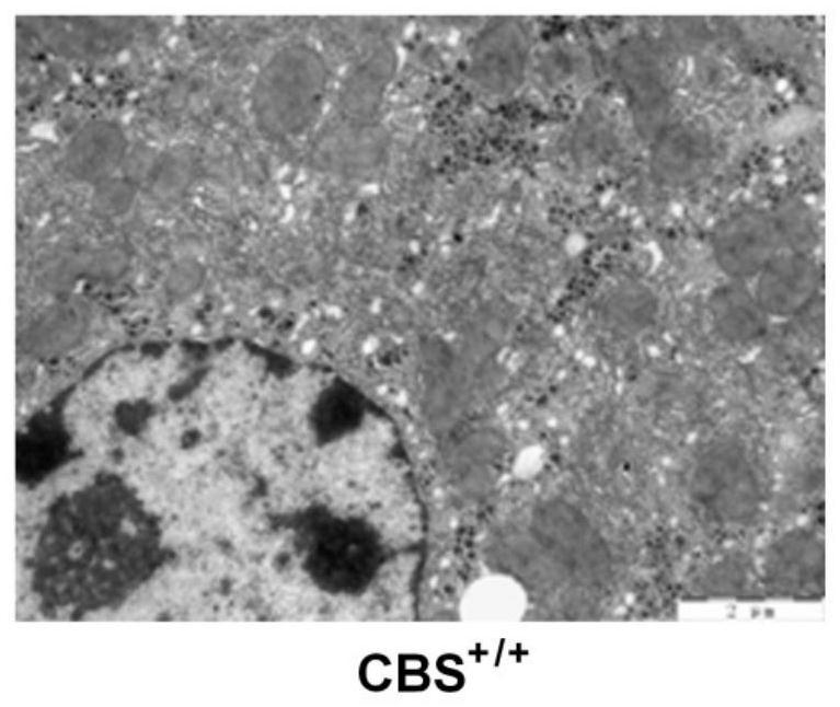 Screening method and application of ERO1alpha molecular marker related to liver injury endoplasmic reticulum stress unfolded protein response