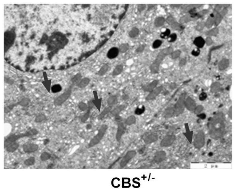 Screening method and application of ERO1alpha molecular marker related to liver injury endoplasmic reticulum stress unfolded protein response