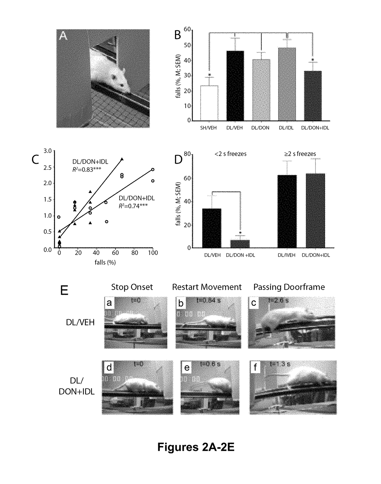 Use of an Acetylcholinesterase Inhibitor and Idalopirdine for Reducing Falls in Parkinson's Disease Patients