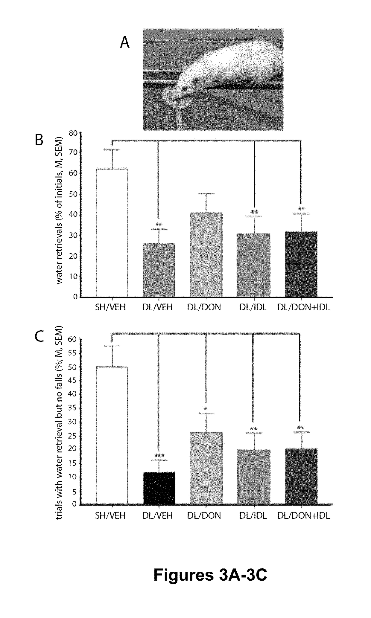 Use of an Acetylcholinesterase Inhibitor and Idalopirdine for Reducing Falls in Parkinson's Disease Patients