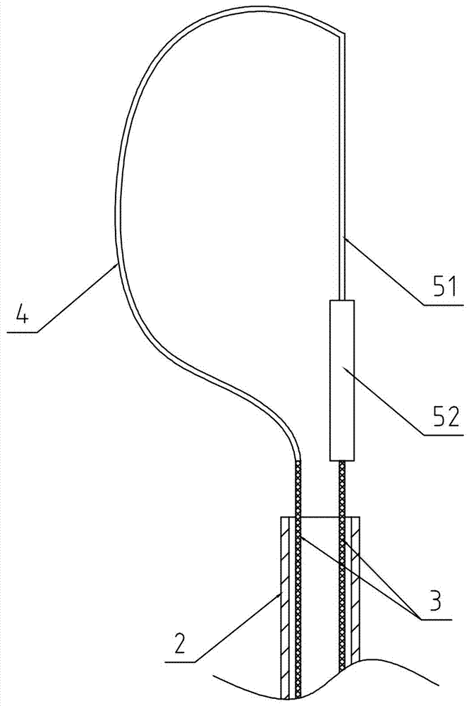 Gastroenterological endoscope loop carrier with scales