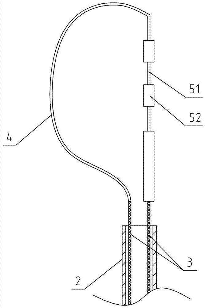 Gastroenterological endoscope loop carrier with scales