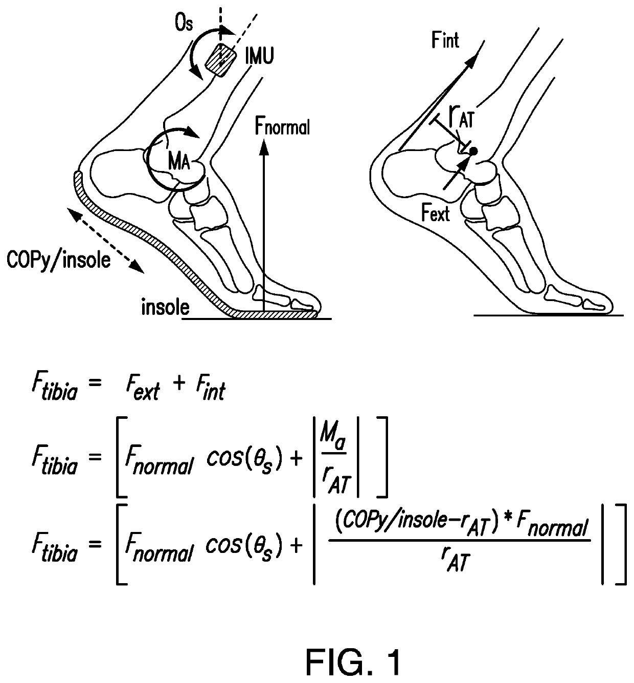 Wearable device to monitor musculoskeletal loading, estimate tissue microdamage and provide injury risk biofeedback