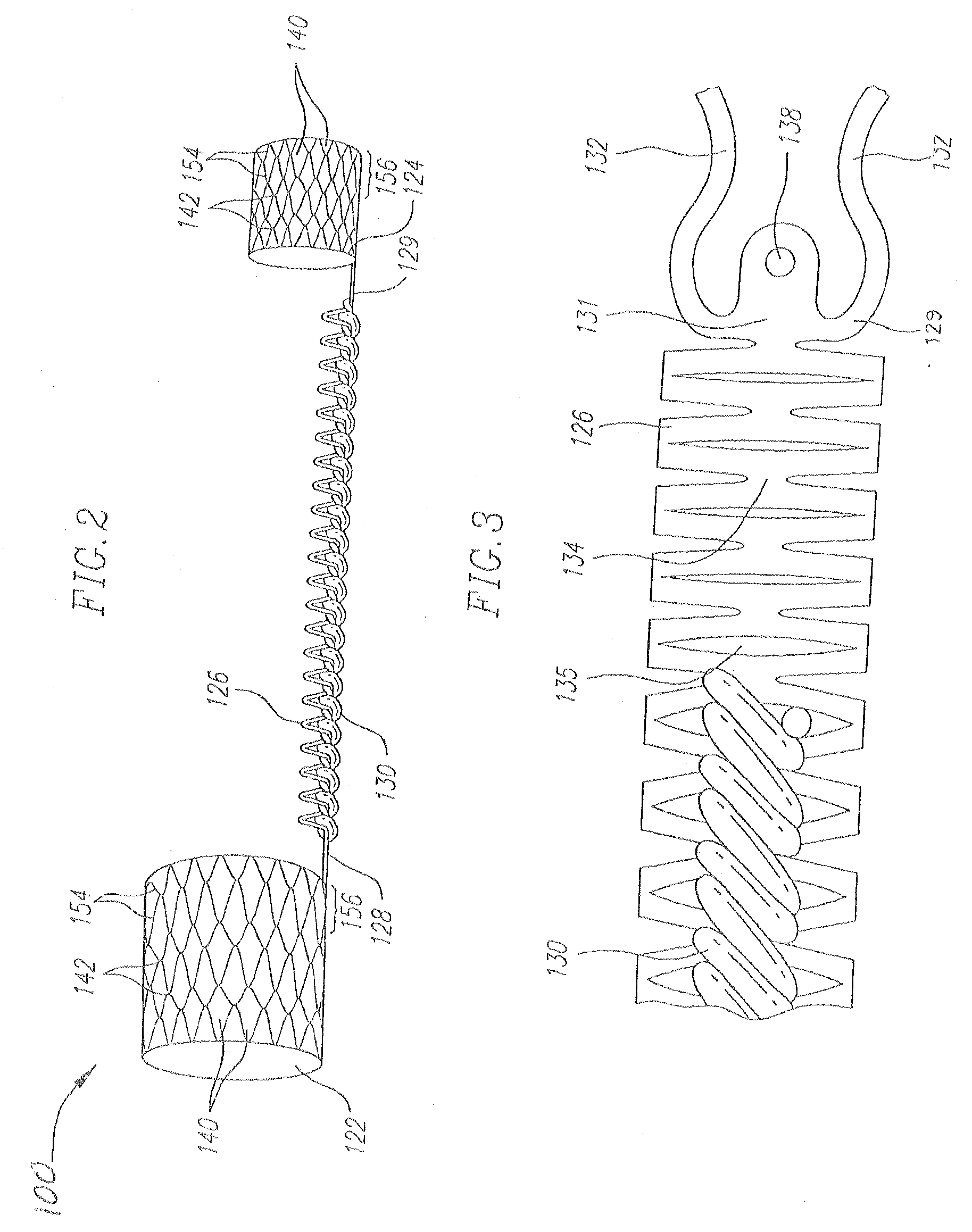 Medical implant with reinforcement mechanism