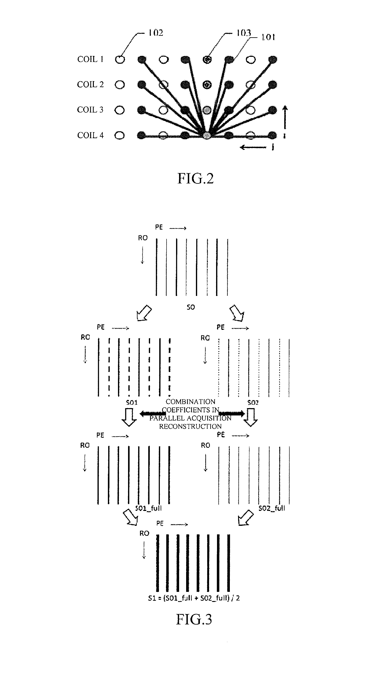 Method and apparatus for eliminating motion artifact in magnetic resonance imaging