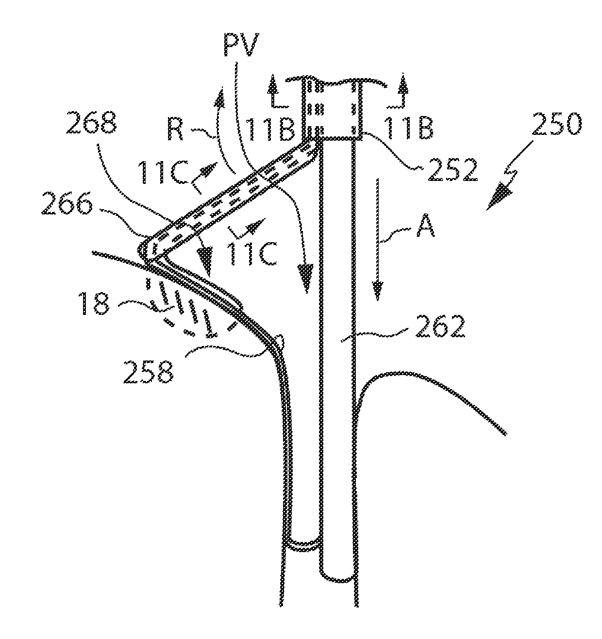 Devices and methods for creating continuous lesions