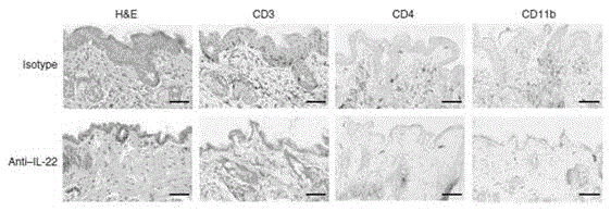 Humanized interleukin-22-resistant genetically engineered antibody and application thereof