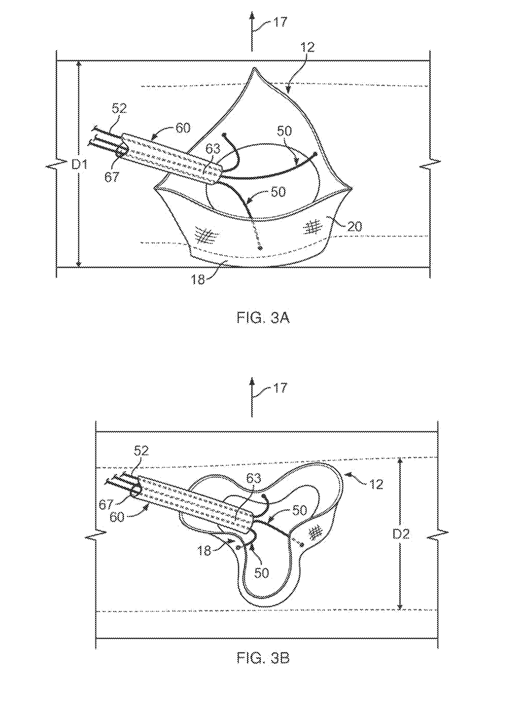 Multiple Component Prosthetic Heart Valve Assemblies and Methods for Delivering Them