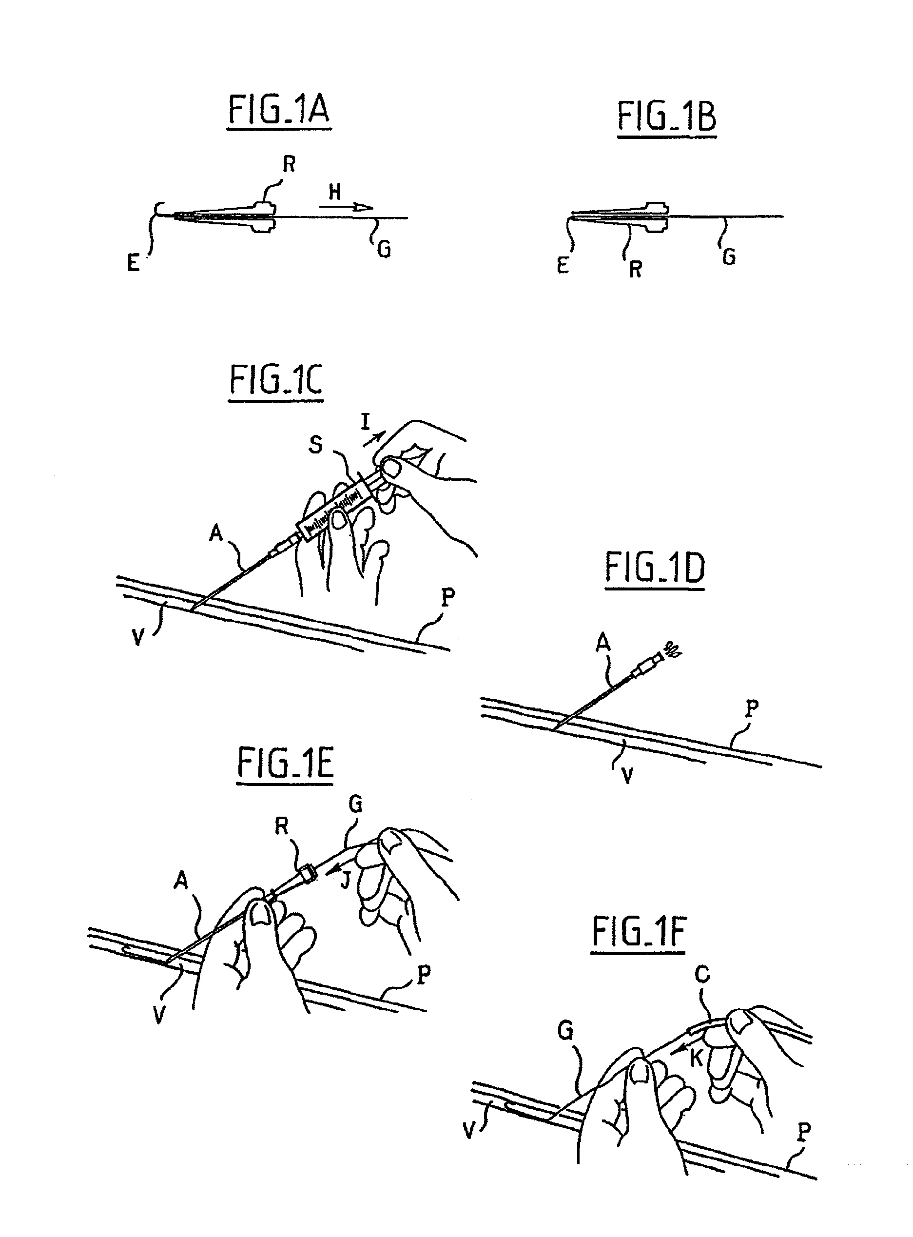 Device for introducing a catheter guide wire into a vessel