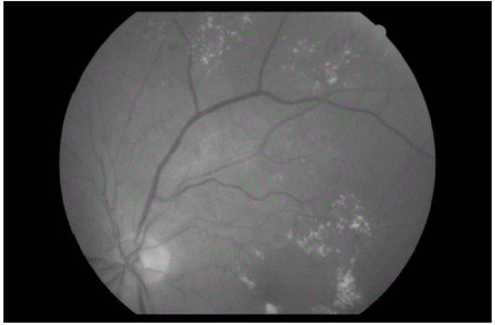 Eye fundus image arteriovenous retinal blood vessel classification method based on breadth first-search algorithm