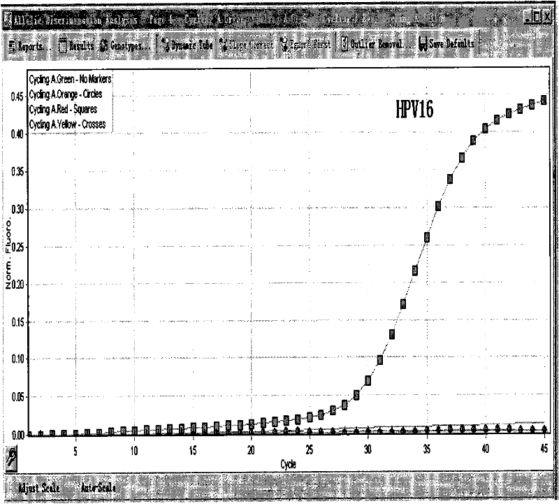 A common type of human papillomavirus quadruple fluorescent quantitative PCR typing detection method