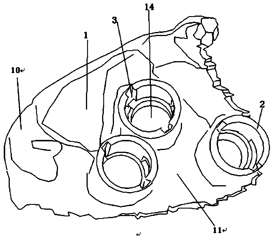 Combined individual sacroiliac joint screw navigation template and manufacturing method