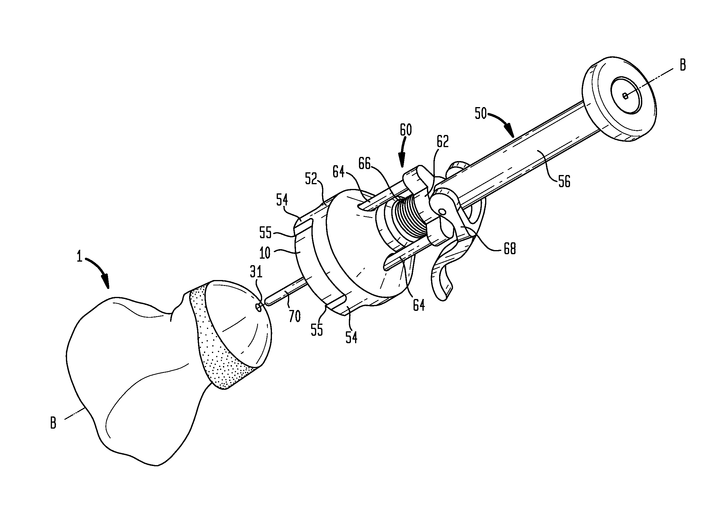 Method and apparatus for hip femoral resurfacing tooling