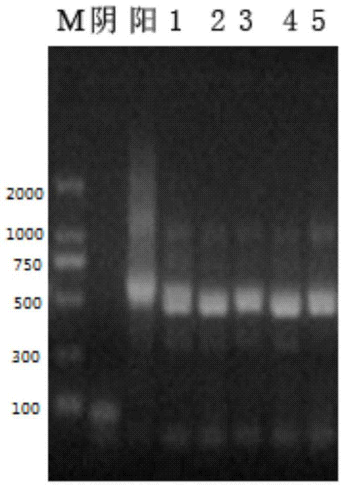 A diazepam lipocalin mimetic antibody