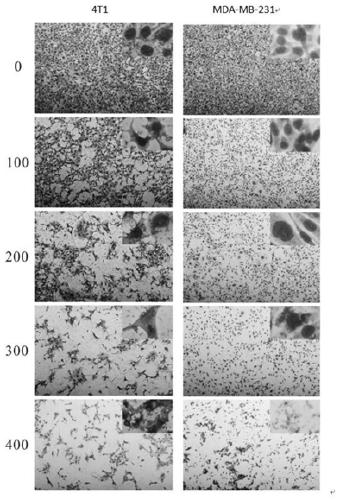 Preparation method of amauroderma rude polysaccharide F212 and application thereof to prevention and/or treatment of breast cancer