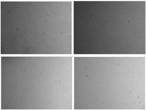 Efficient separation and amplification method for human amniotic mesenchymal stem cells