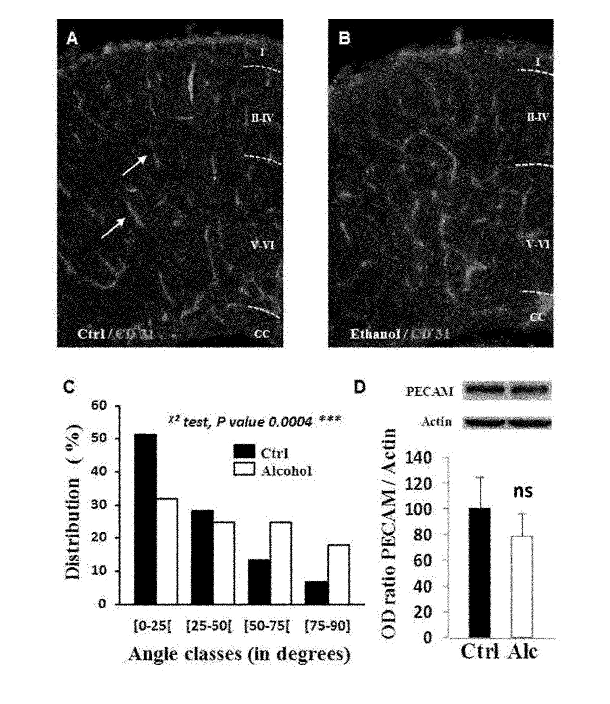 Method for the diagnosis of disorders caused by fetal alcohol syndrome