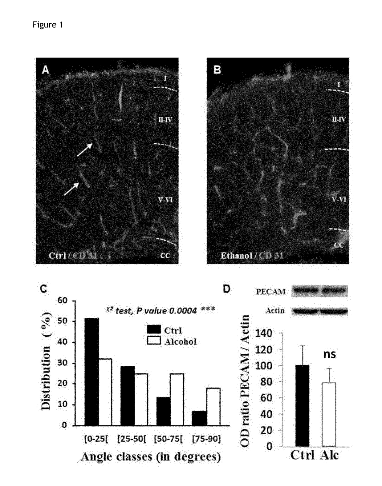 Method for the diagnosis of disorders caused by fetal alcohol syndrome