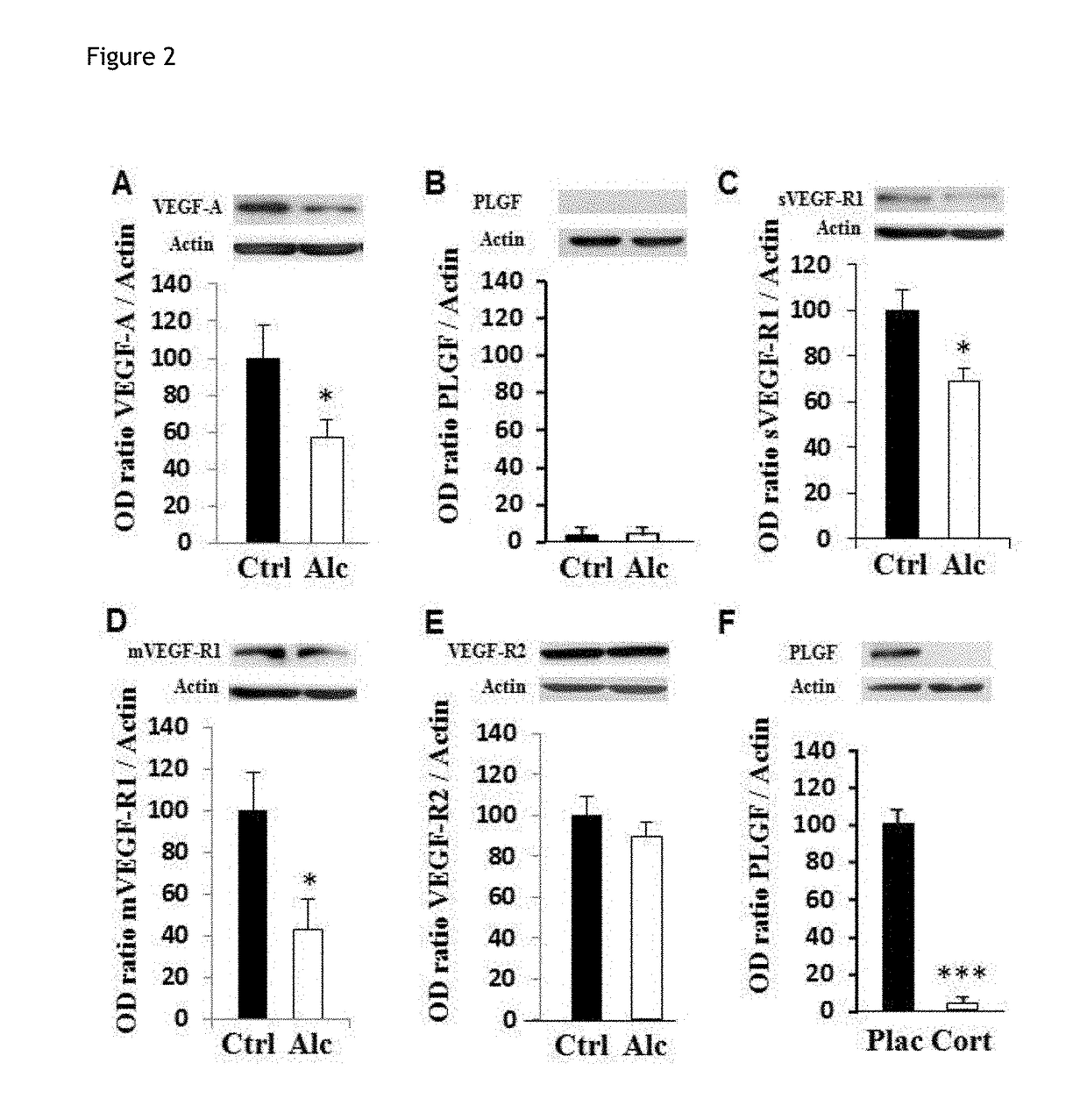 Method for the diagnosis of disorders caused by fetal alcohol syndrome