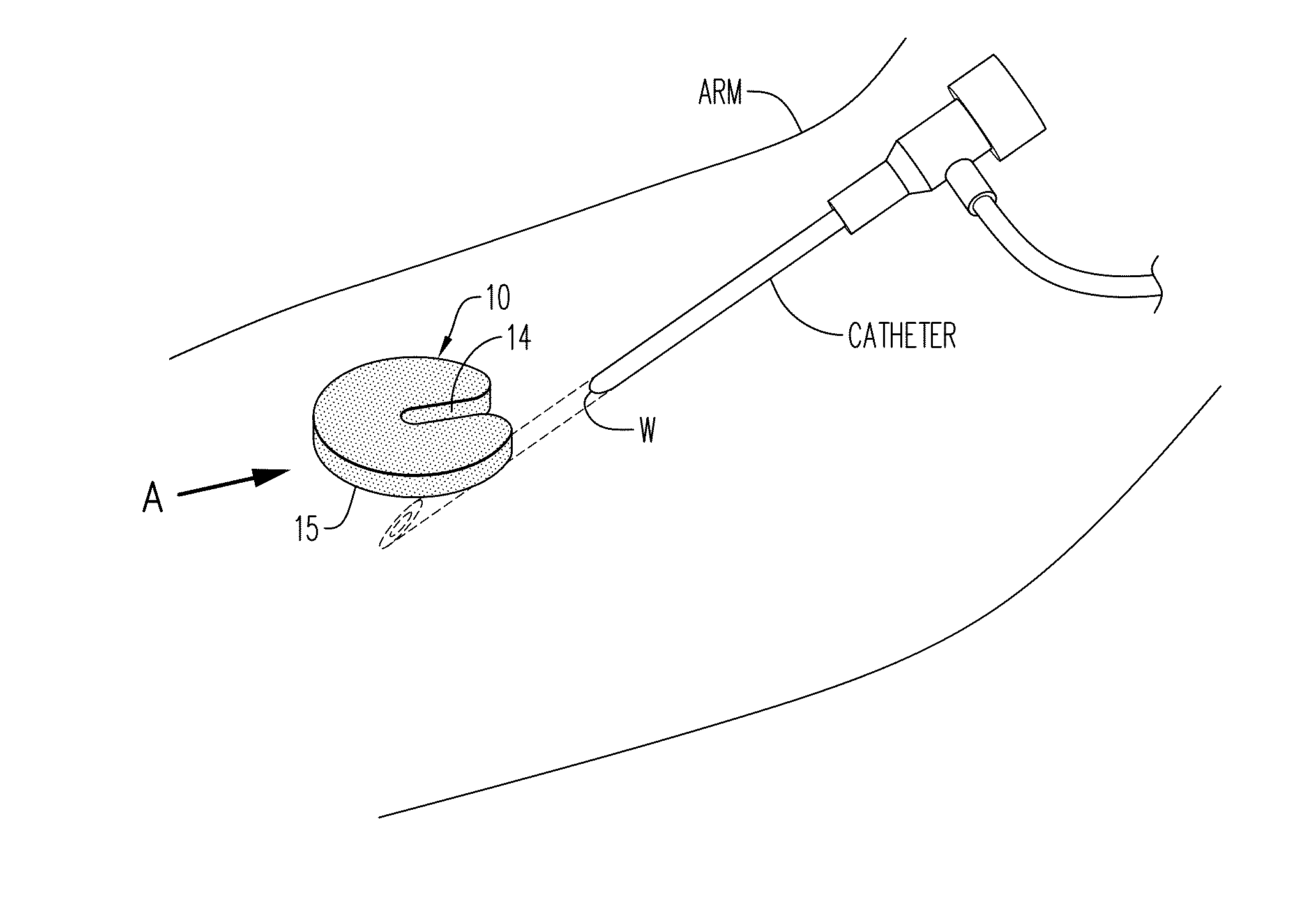 Hemostatic device and method